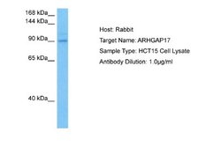 ARHGAP17 Rabbit anti-Human, Polyclonal, Novus Biologicals 0.1ml; Unconjugated:Antibodies,